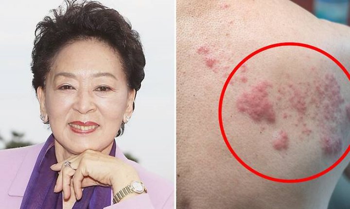 故김지미 사망케 한「그 병」의 정체, 바늘 수백 개가 찌르는 고통…