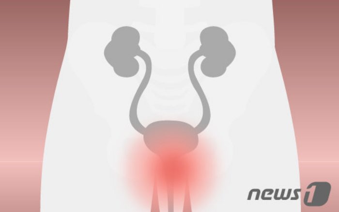 고령화와 함께 늘어나는 전립선비대증…최소침습 치료「아이틴드」주목