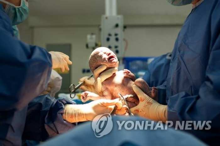 내년부터 「제왕절개」도 자연분만처럼 진료비 본인부담 「무료」