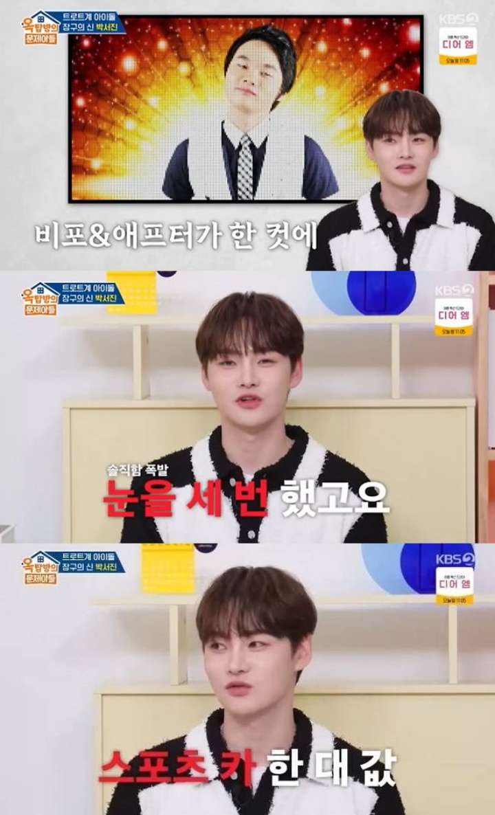 박서진 가수, 억대 성형수술『얼굴 전체 갈아끼워』