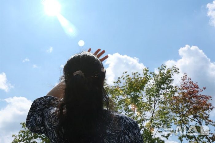 『온몸에 하얀 반점』…뜨거운 가을햇빛에「백반증」주의보