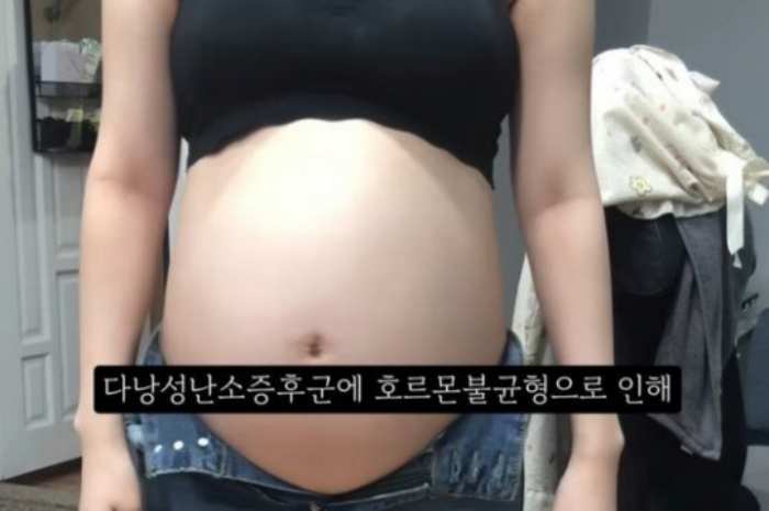 [속보]「36주 낙태」 유튜버는 지방 거주 20대 女…영상 진짜였다